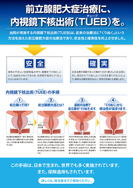 前立腺肥大症治療に、内視鏡下核手術（TUEB）を。手順図解